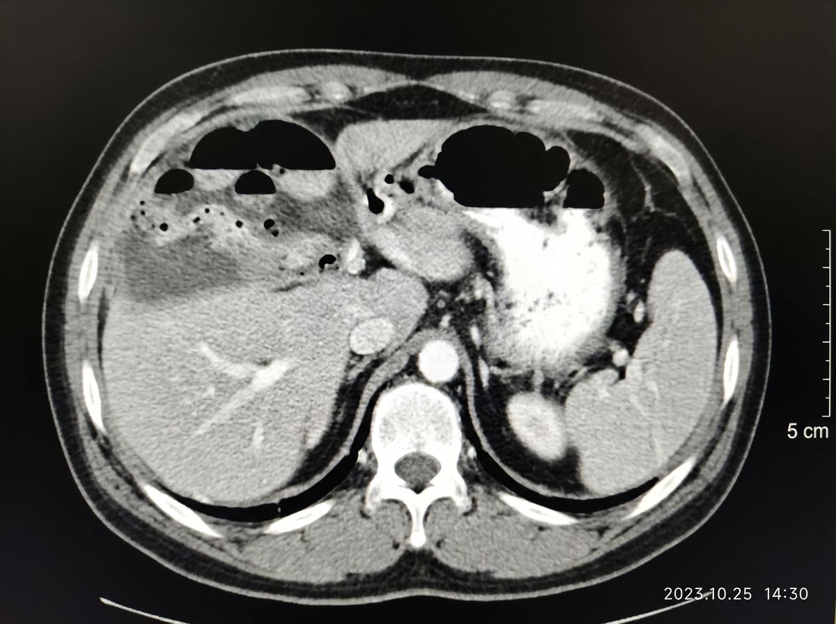 Image for question 100