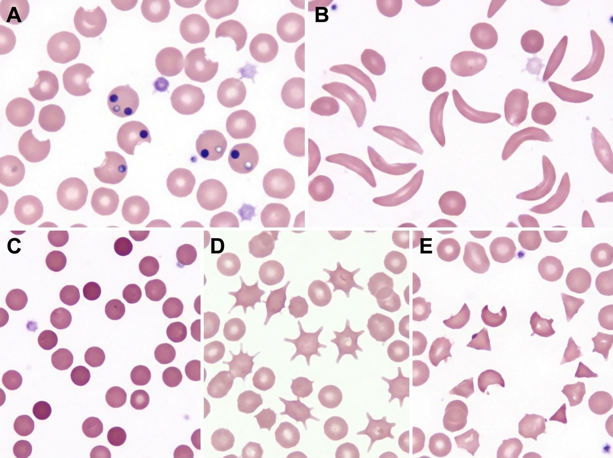 Image for question 1