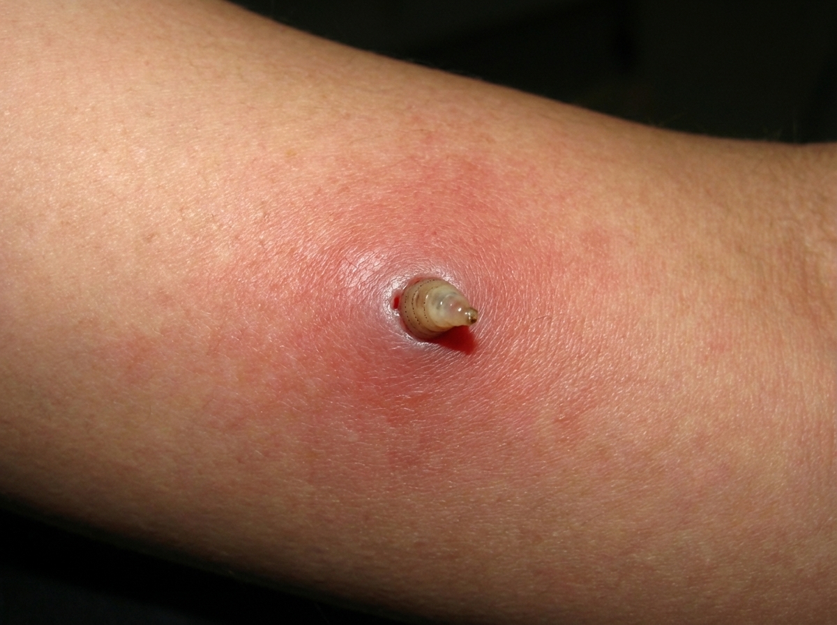 Image for question 136