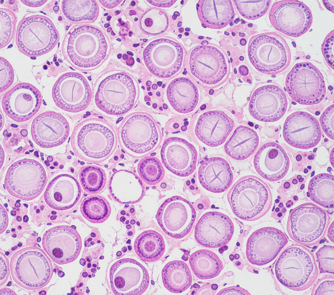 Image for question 71