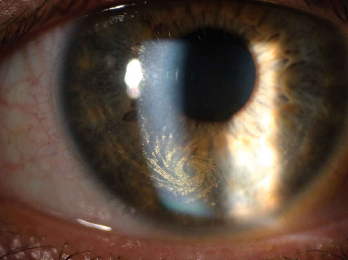 Image for question 277