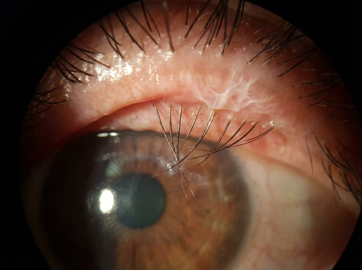 Image for question 115