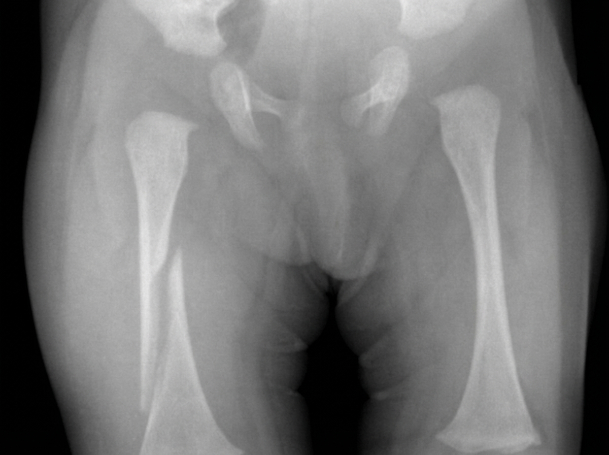 Image for question 443