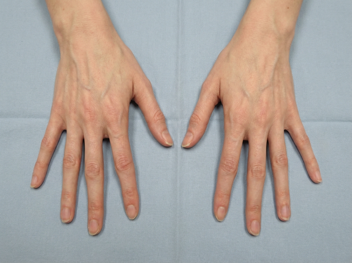 Image for question 548