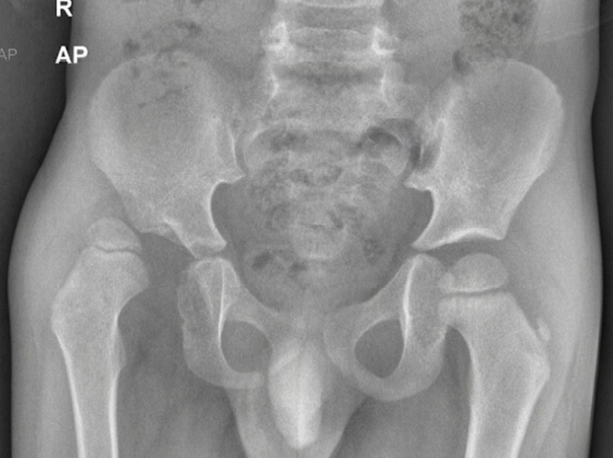 Image for question 103