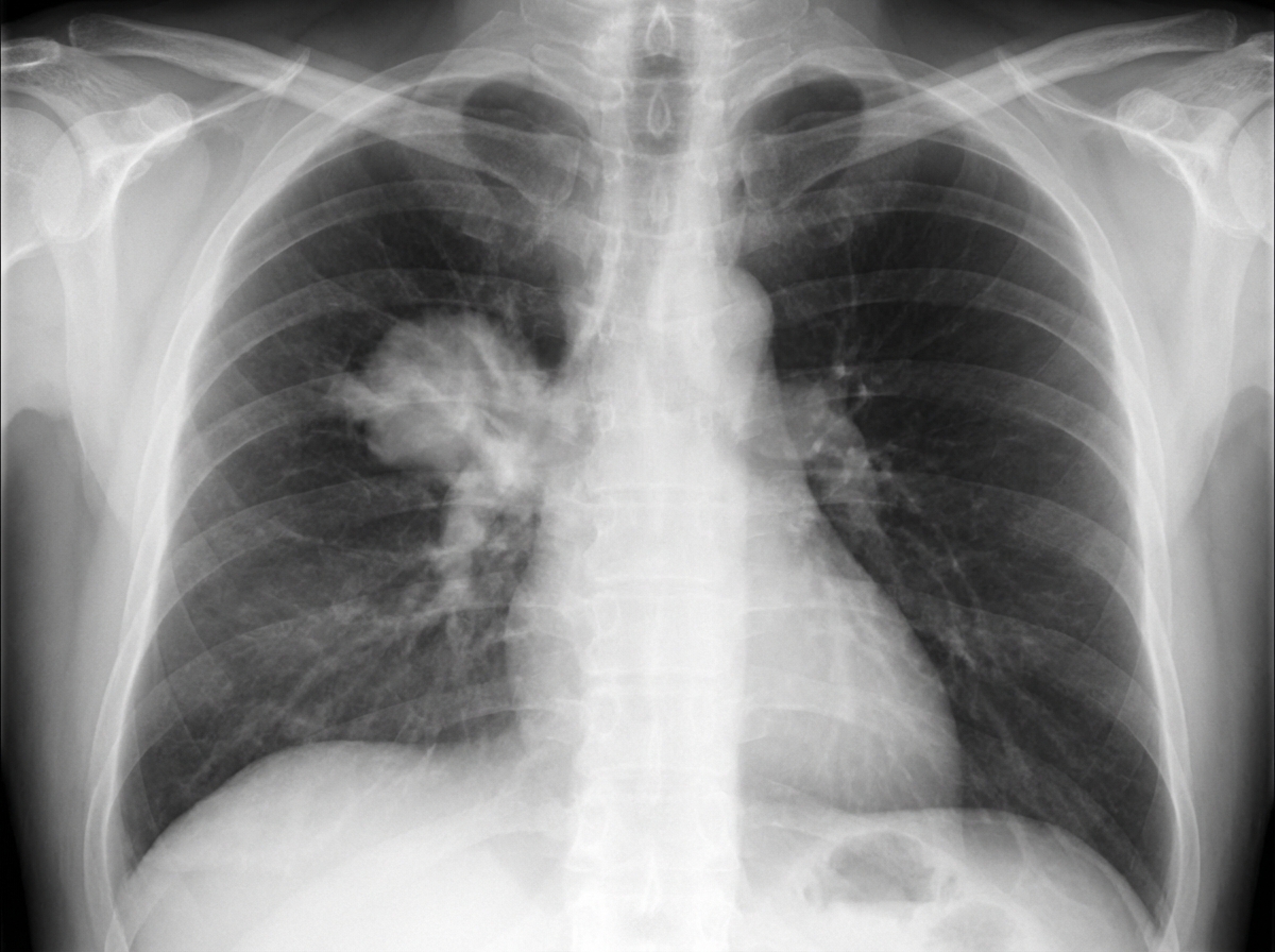 Image for question 867