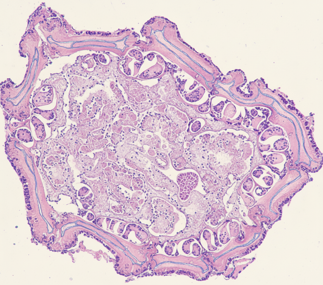 Image for question 227