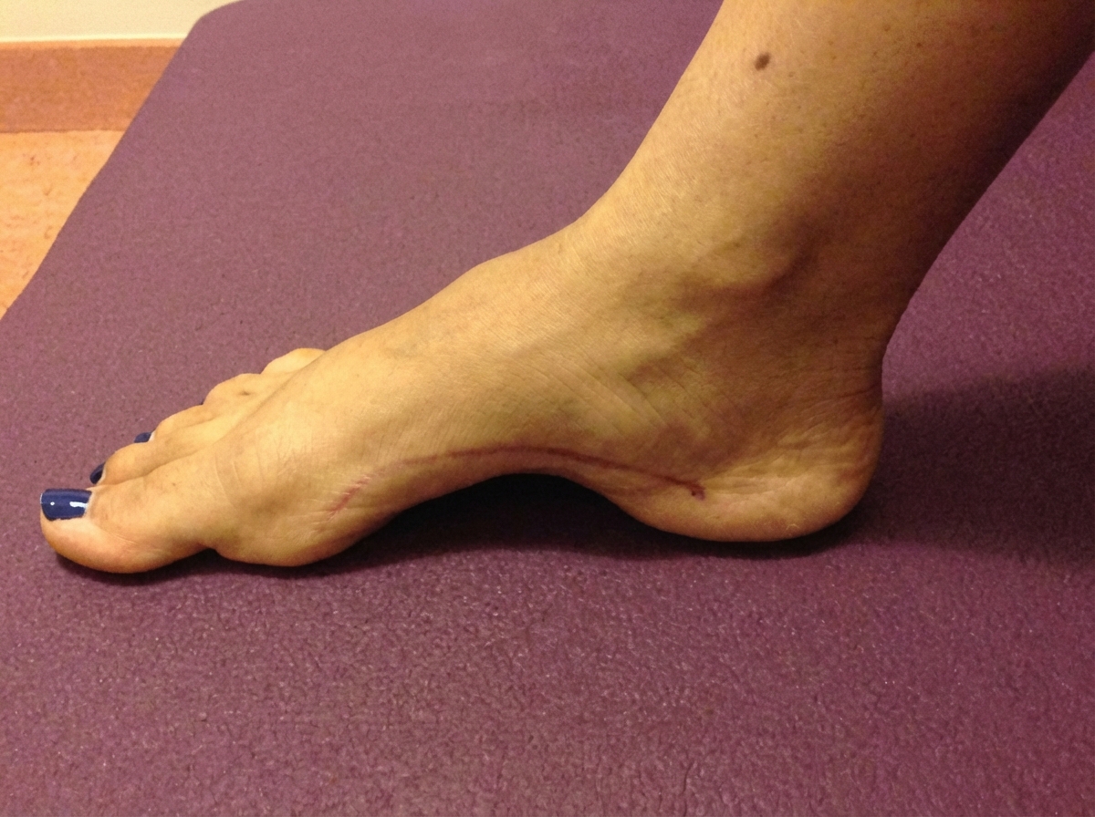 Image for question 159