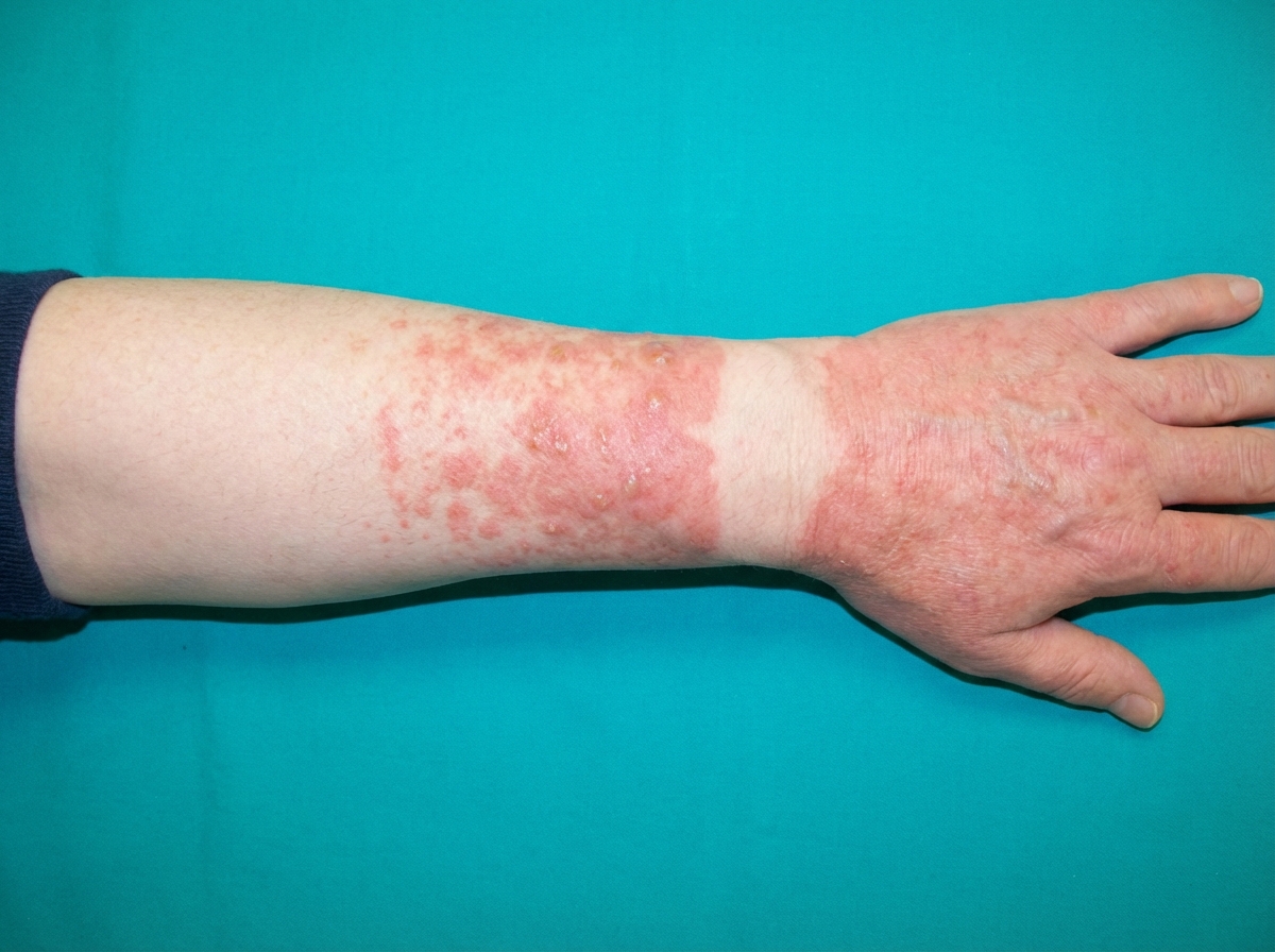 Image for question 389