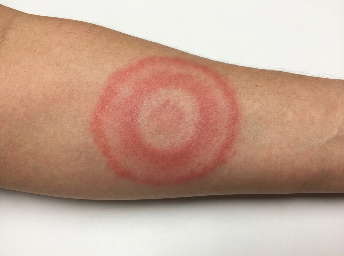 Image for question 33