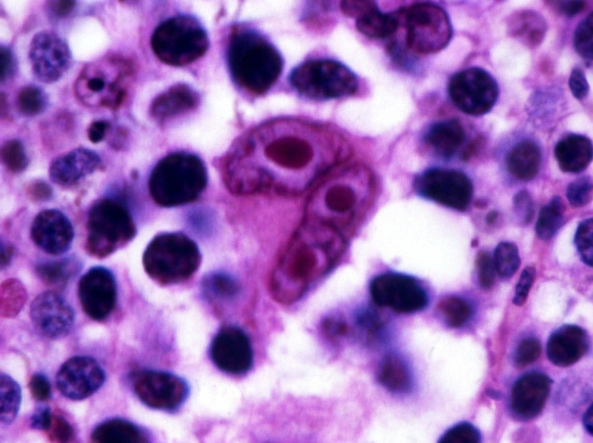 Image for question 645