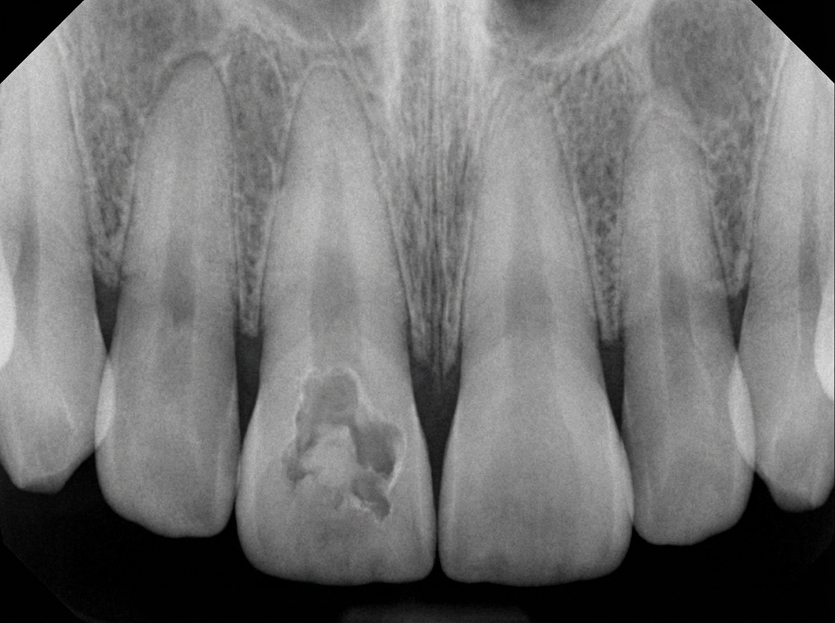 Image for question 202