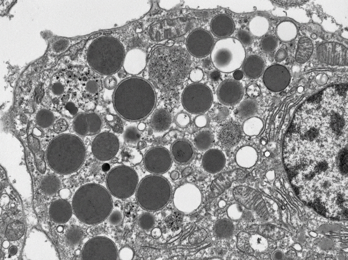 Image for question 219