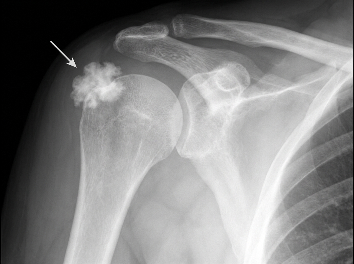 Image for question 53