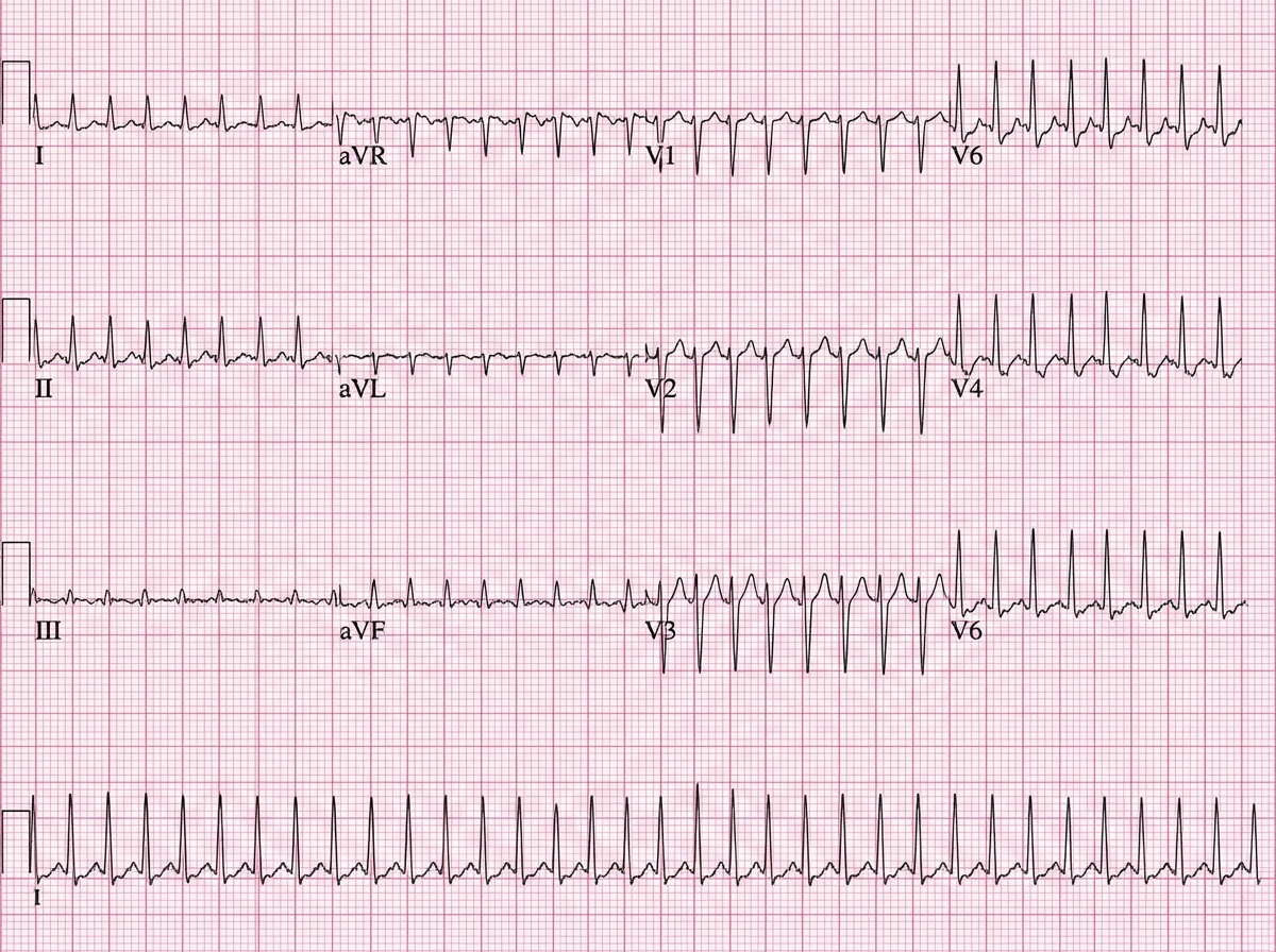 Image for question 7
