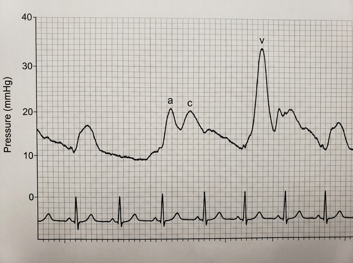 Image for question 400