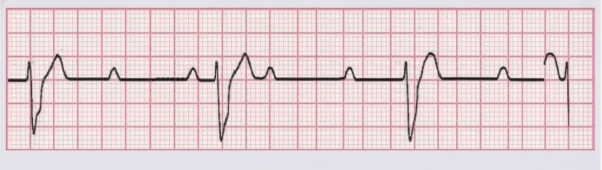 Image for question 528