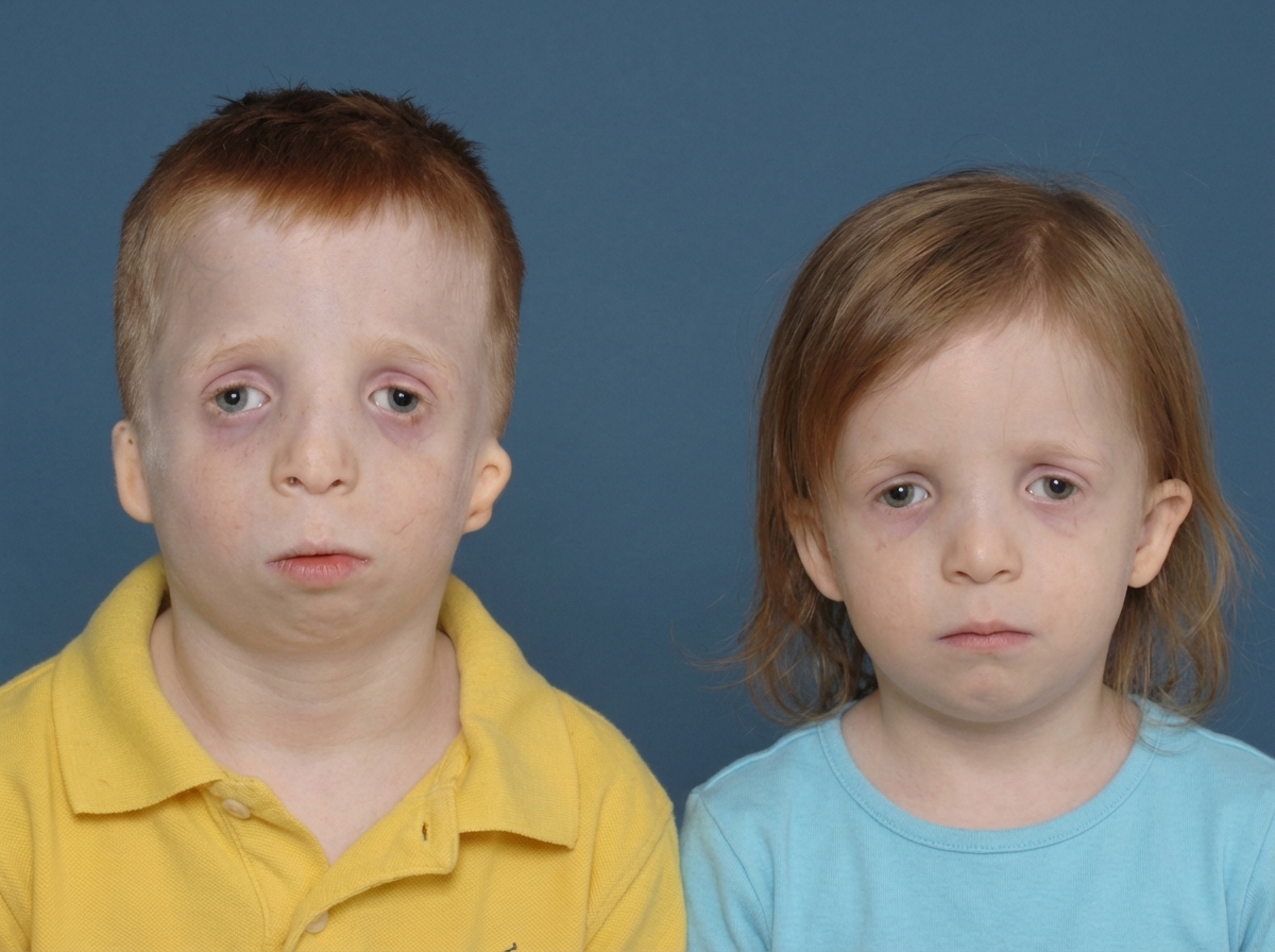 Image for question 599