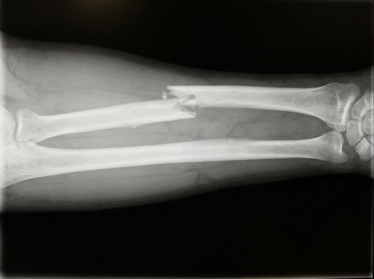 Image for question 560