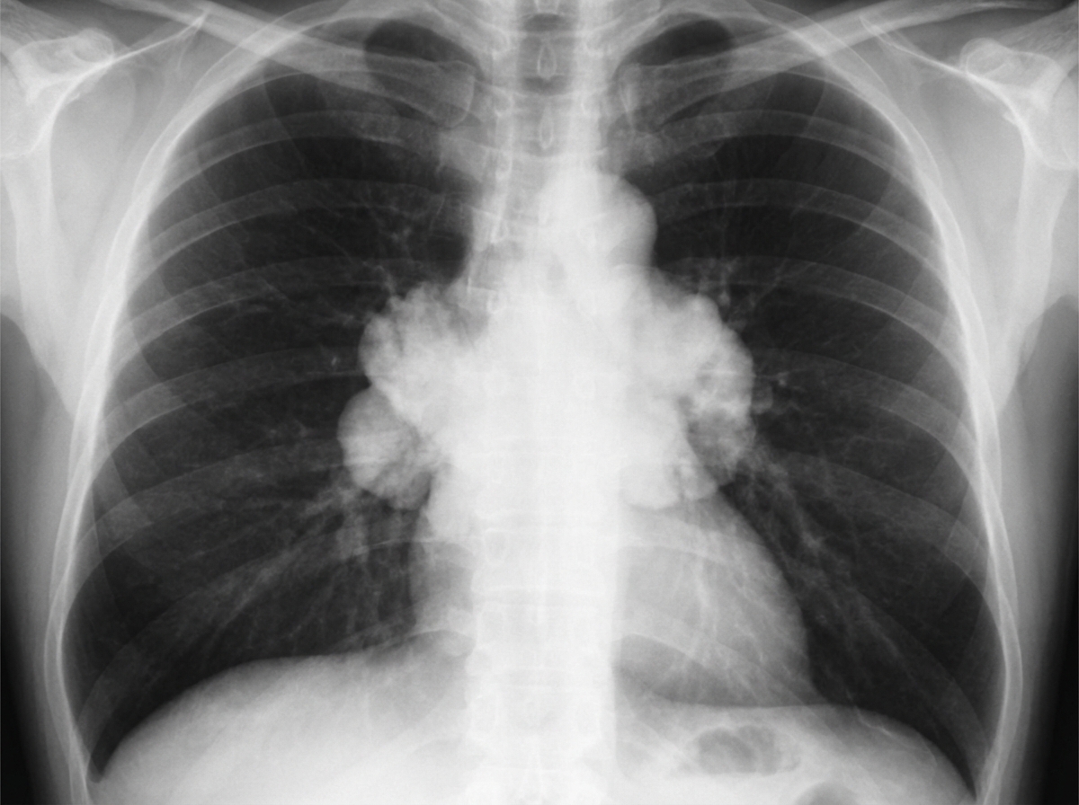 Image for question 518