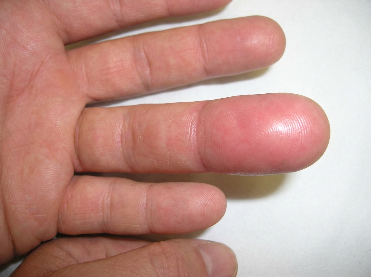 Image for question 43