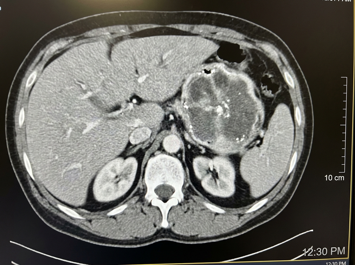 Image for question 848