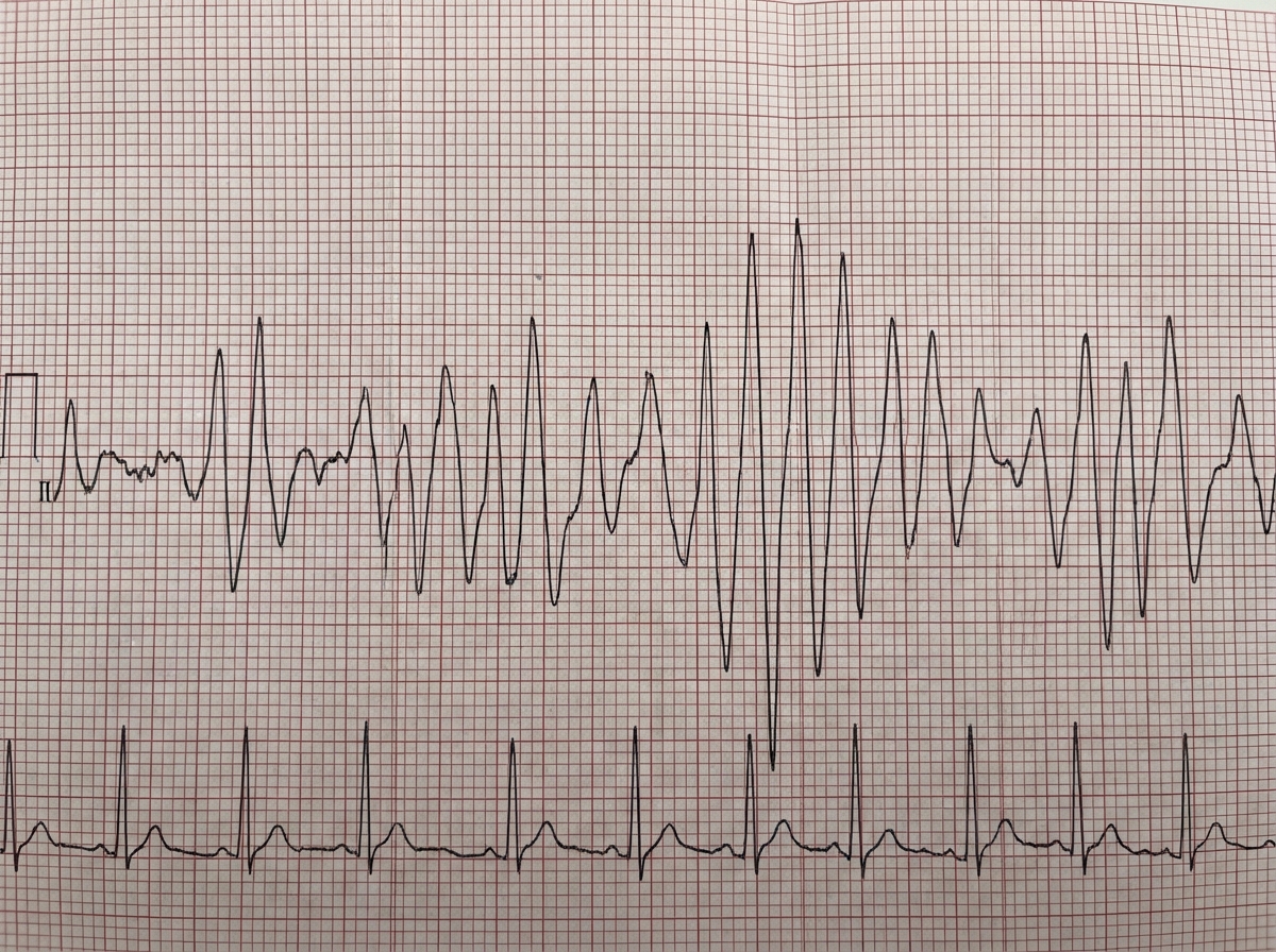 Image for question 157