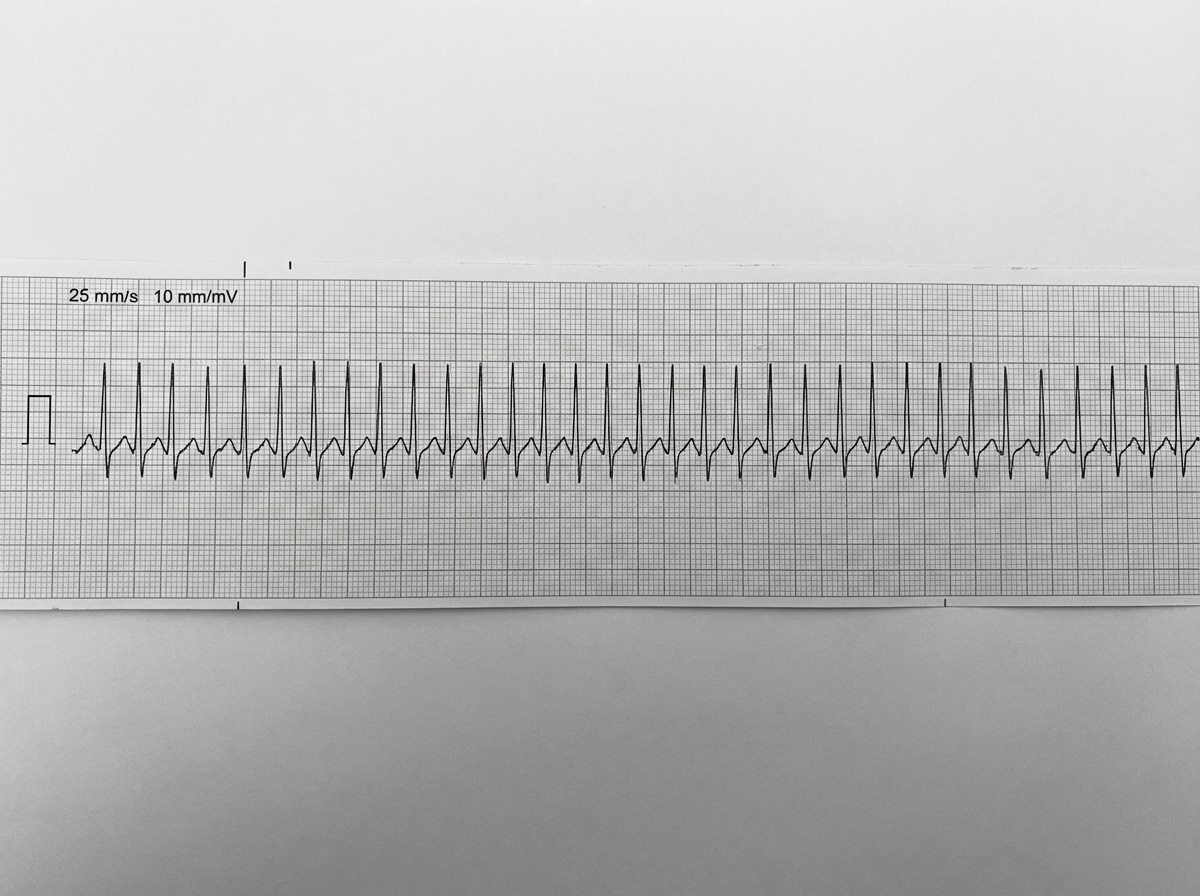 Image for question 260