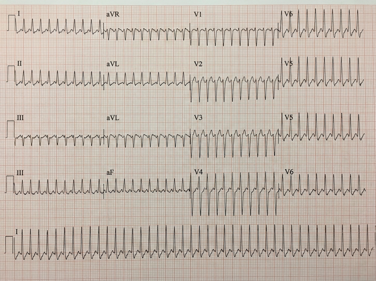 Image for question 7