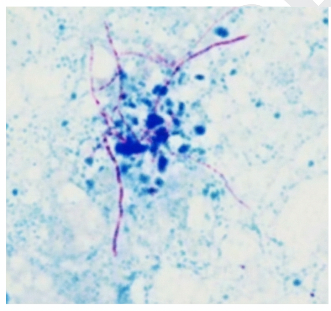 Image for question 346