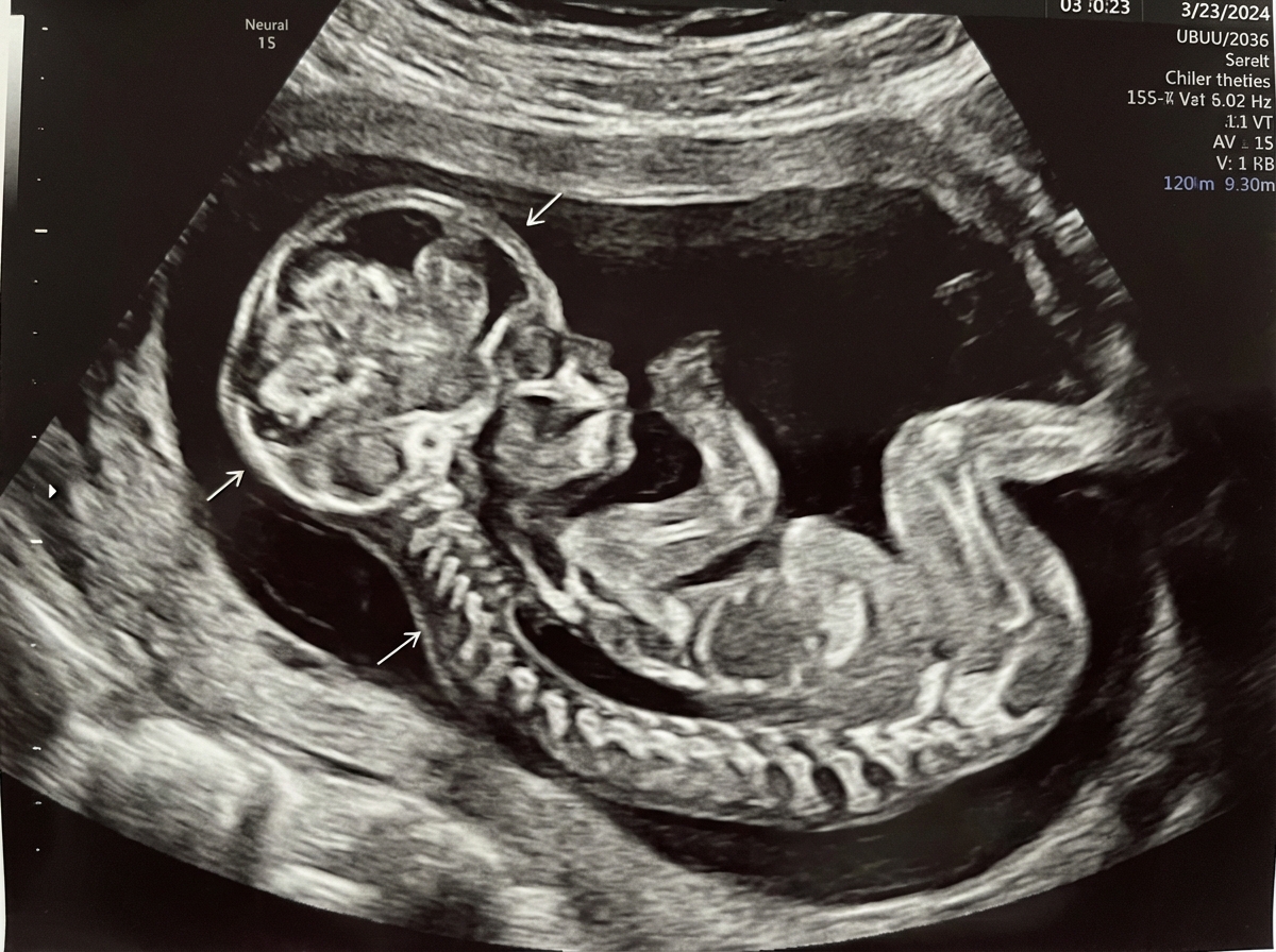 Image for question 309