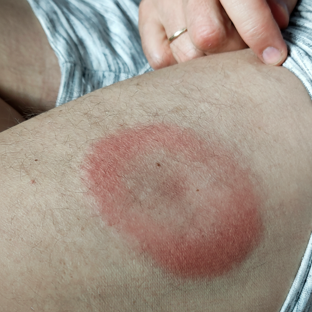 Image for question 85