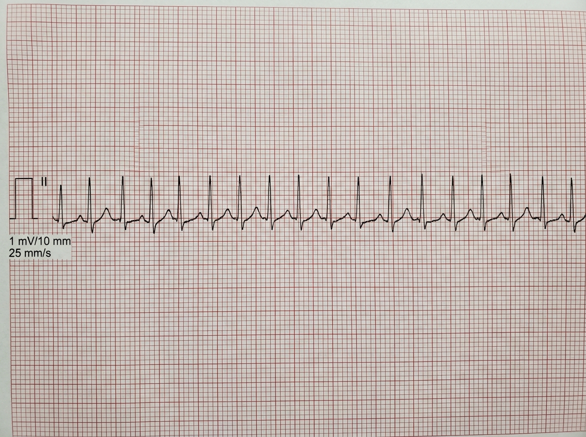Image for question 108