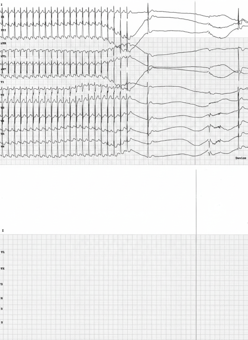 Image for question 849