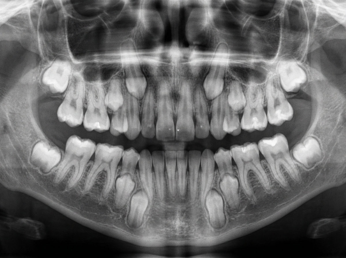 Image for question 107