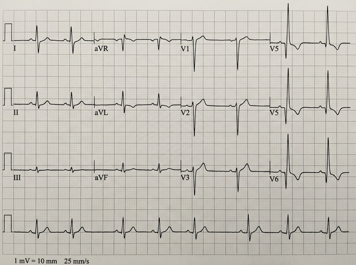 Image for question 817