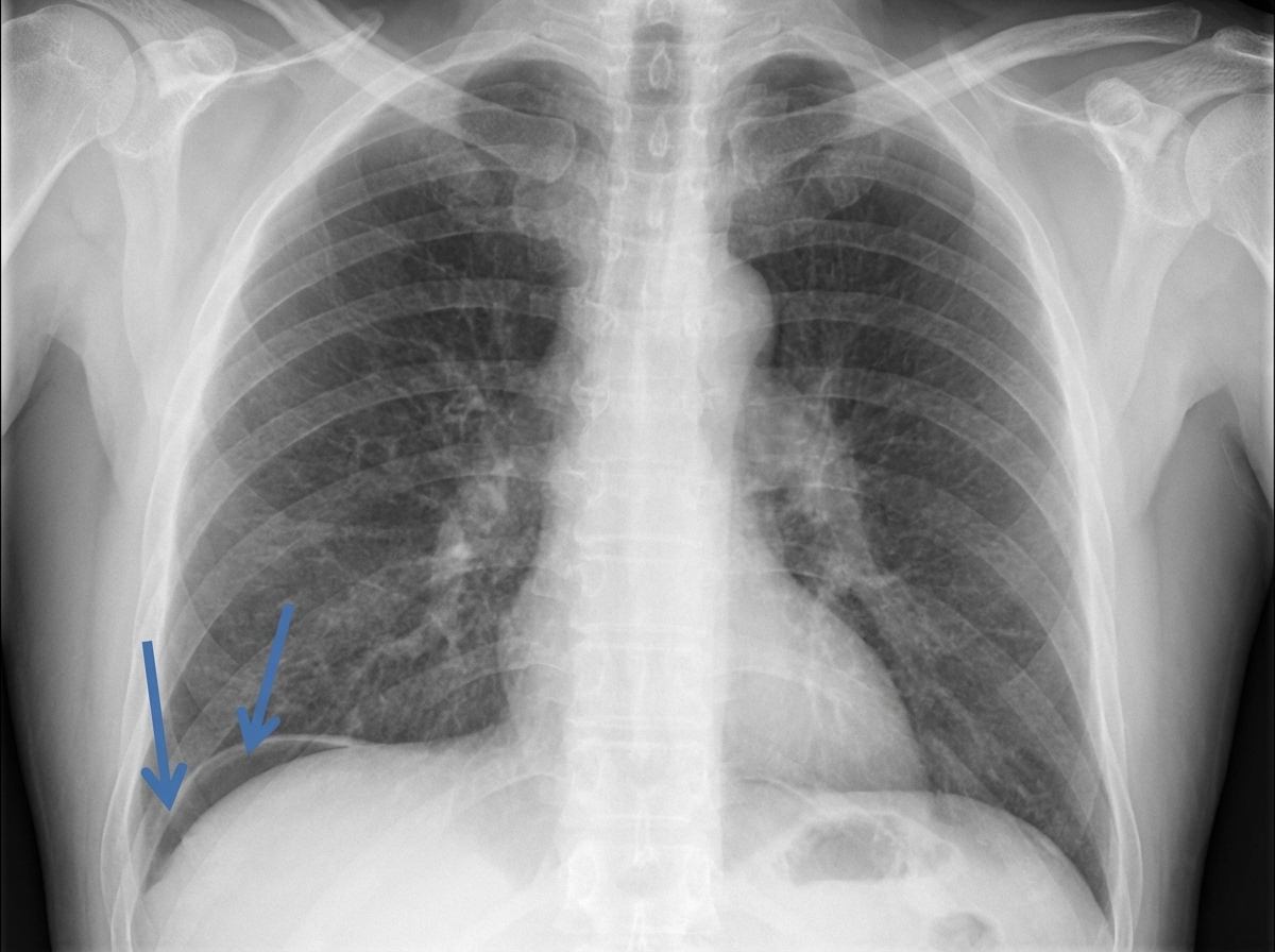 Image for question 61