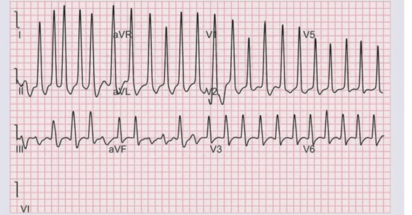 Image for question 958