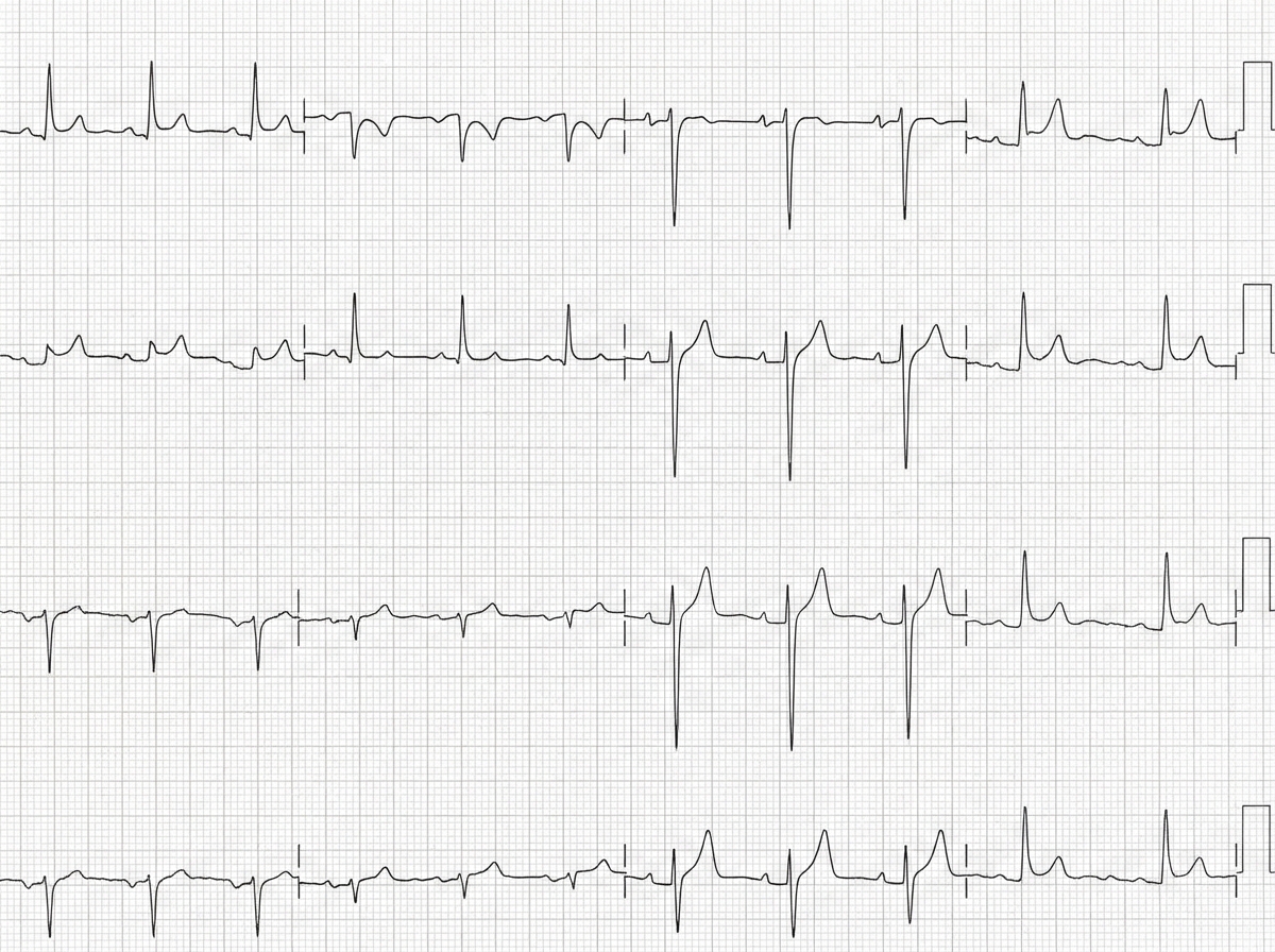 Image for question 163