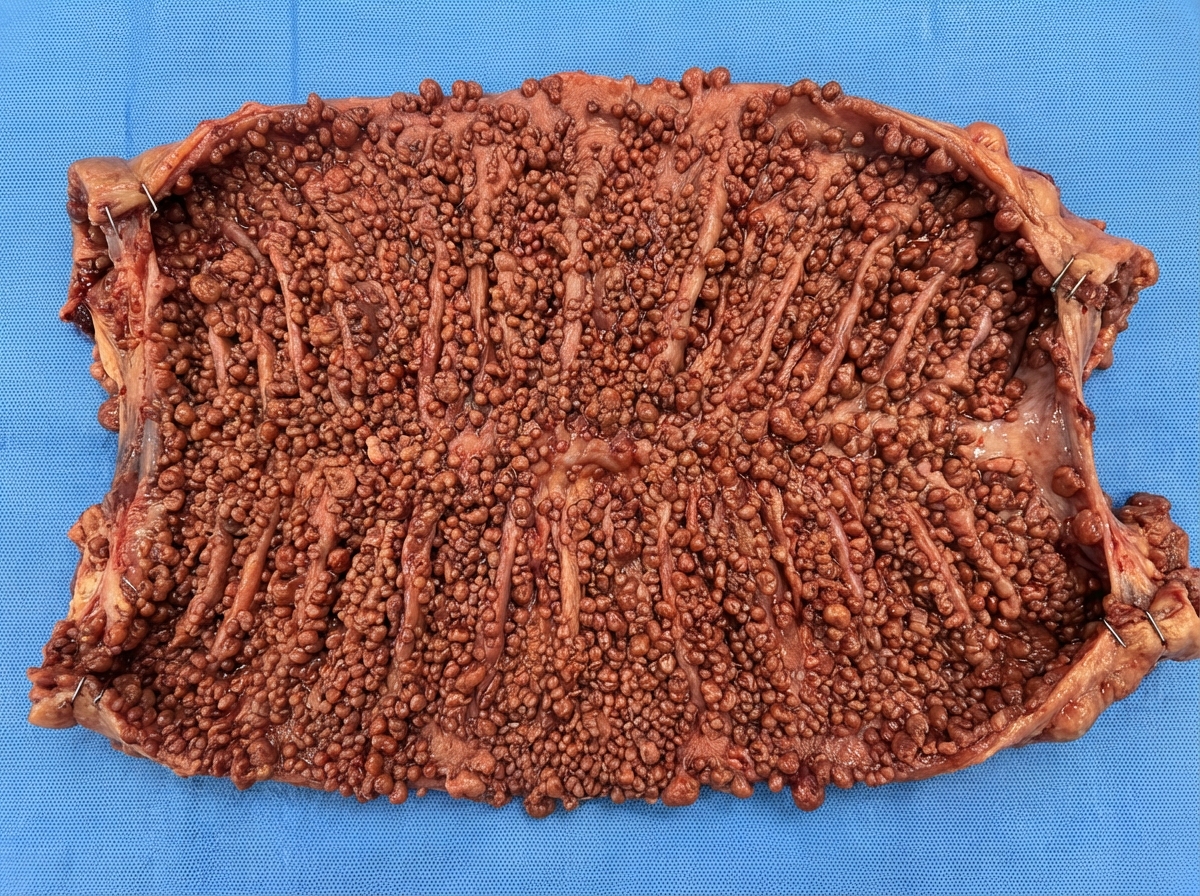 Image for question 188