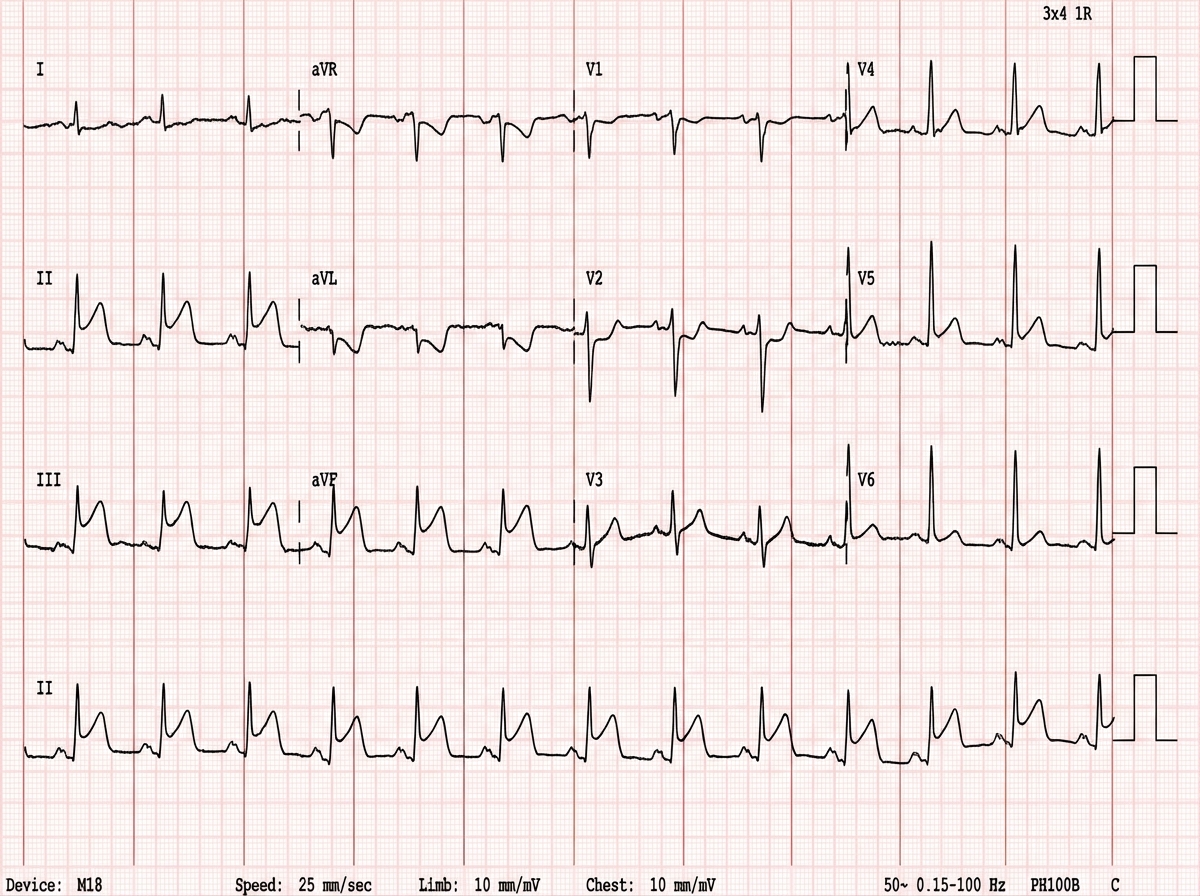 Image for question 35