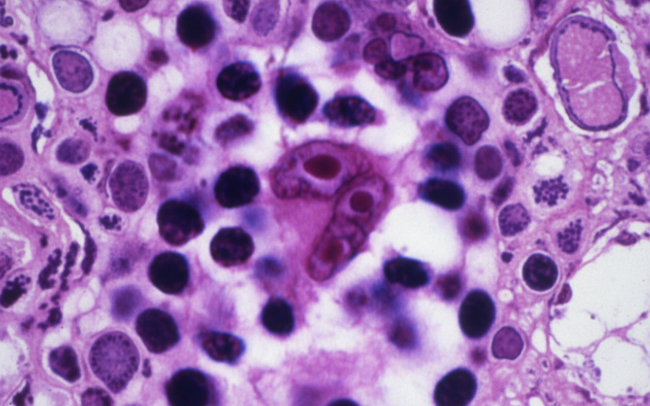 Image for question 35