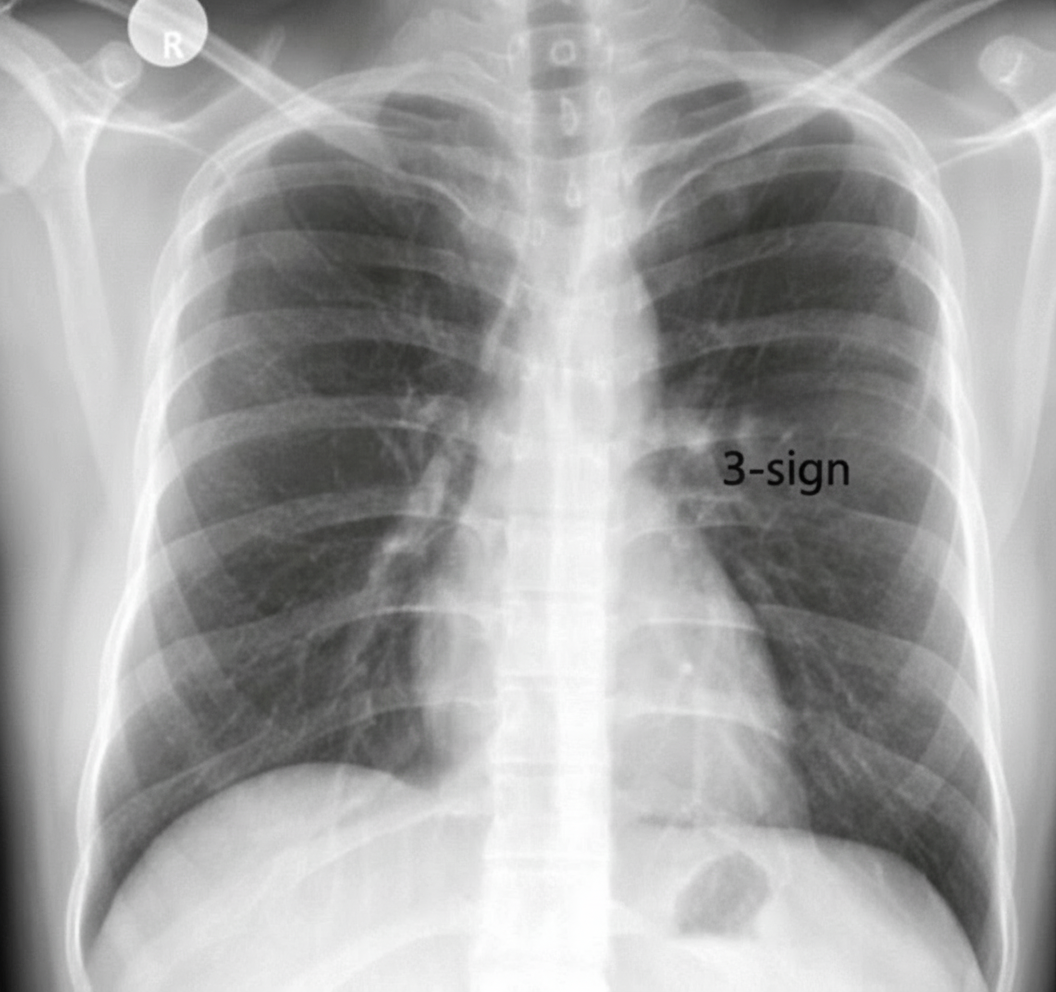 Image for question 229