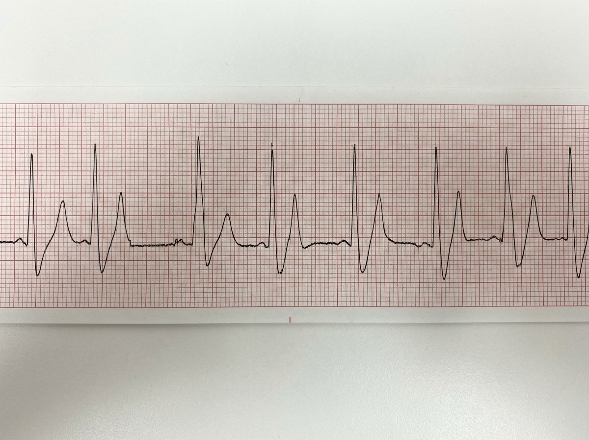 Image for question 900