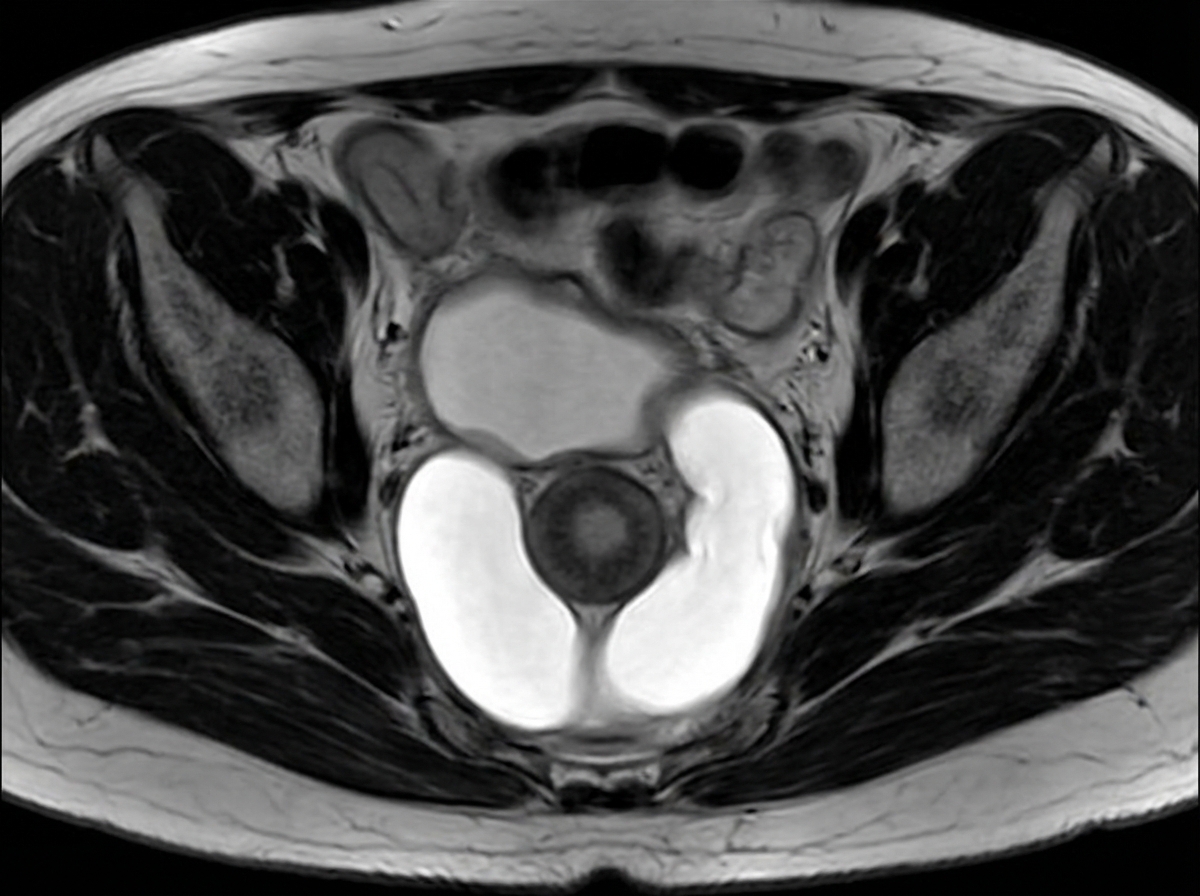 Image for question 590