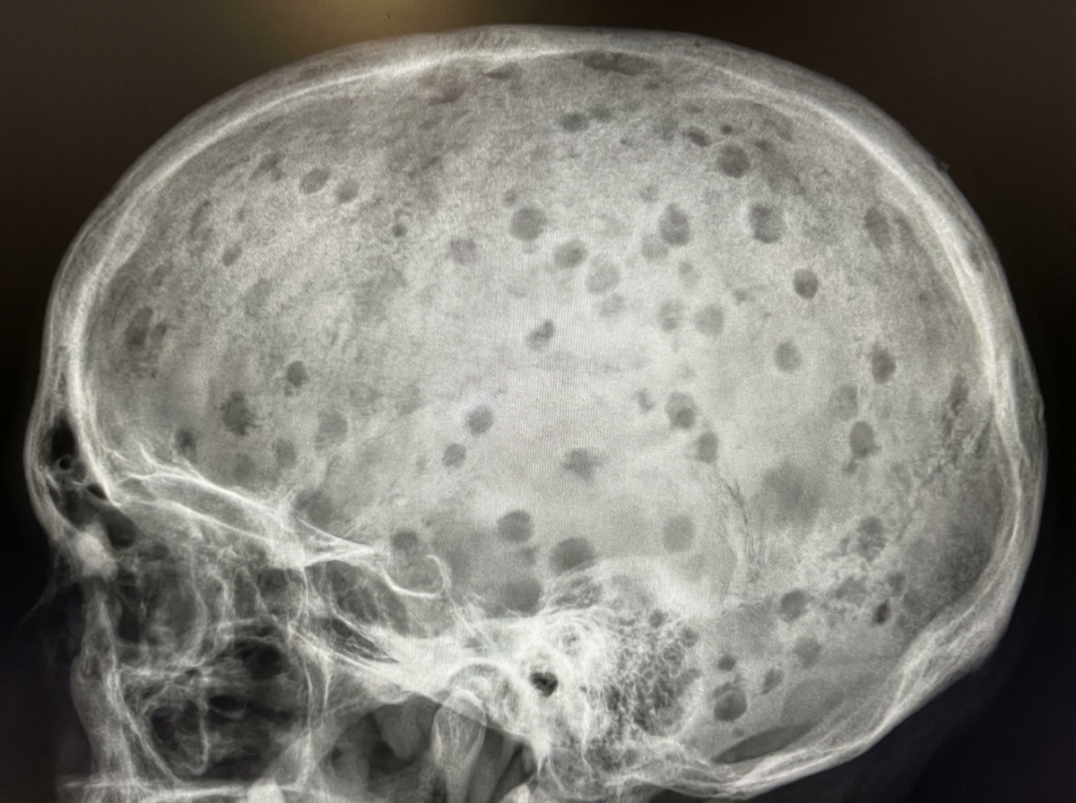 Image for question 92