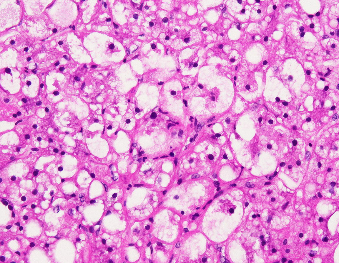 Image for question 84