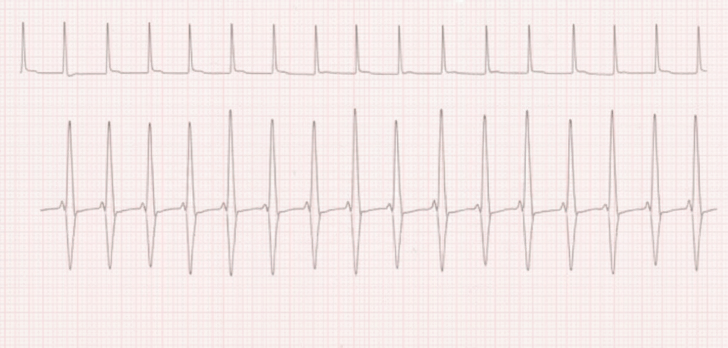 Image for question 709