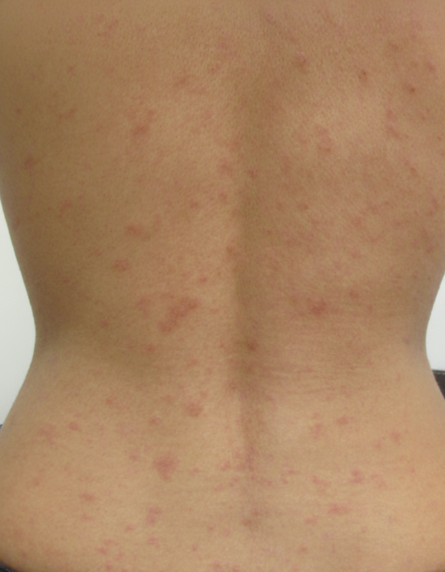 Image for question 90