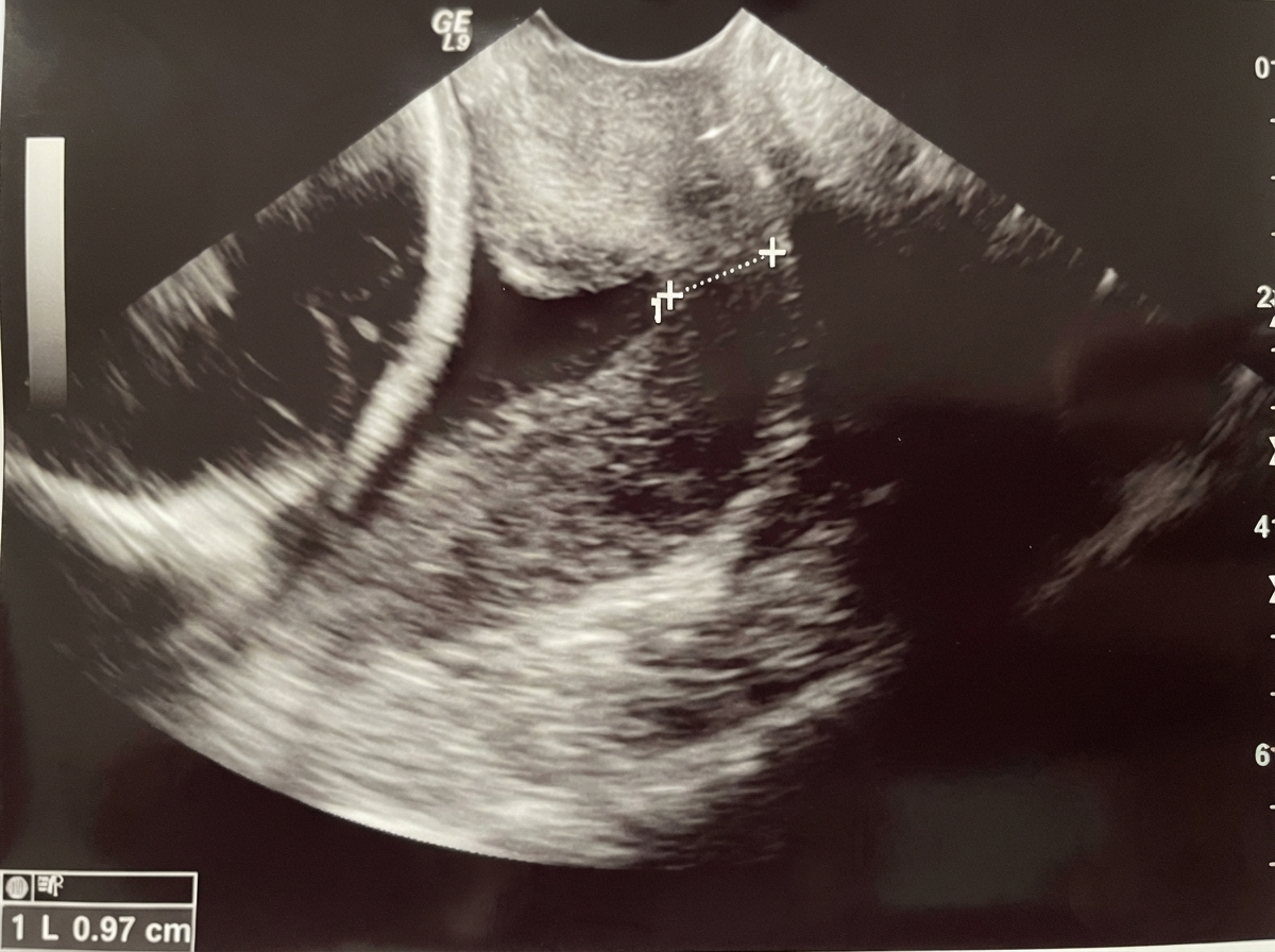 Image for question 413